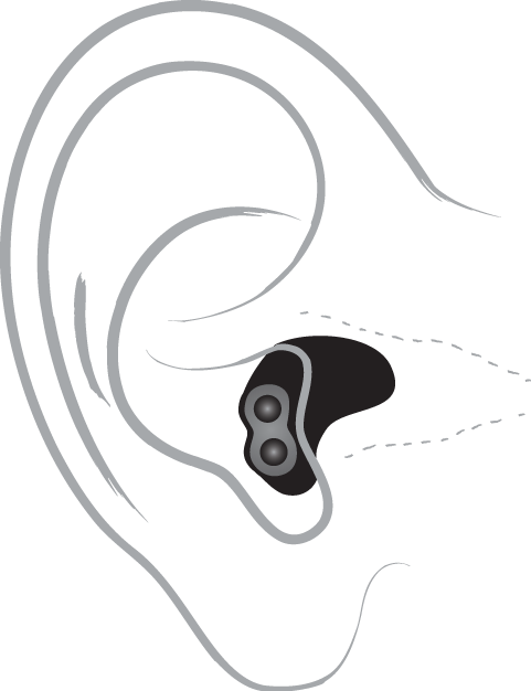 A technical drawing of a completely-in-canal hearing aid