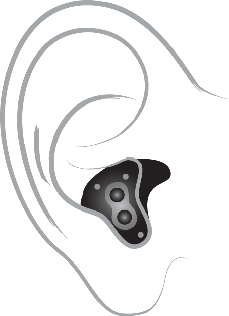 A technical drawing of an in-the-canal hearing aid