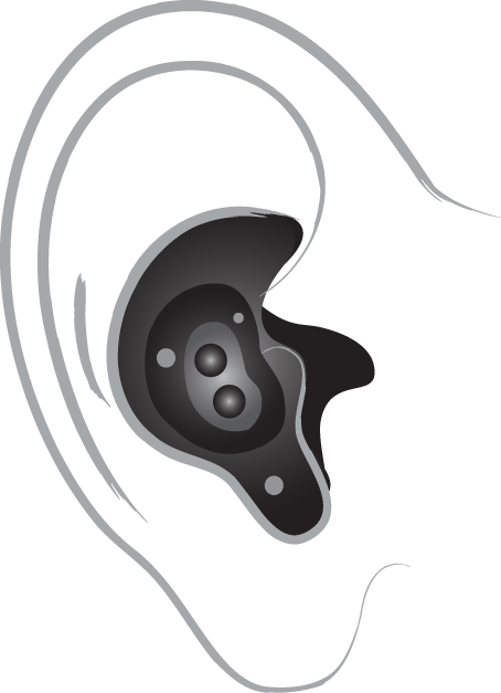 A technical drawing of an in-the-ear hearing aid