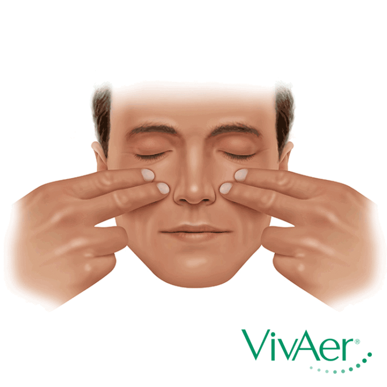 An illustration of a man using the Cottle Maneuver.  He presses two fingers from each hand to either side of his nose.